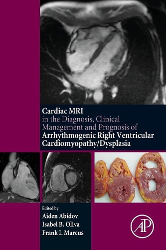 Paper book «Cardiac MRI in Diagnosis, Clinical Management, and Prognosis of Arrhythmogenic Right Ventricular Cardiomyopathy/Dysplasia», authors Aiden Abidov, Frank I Marcus, Isabel Oliva - фото №1