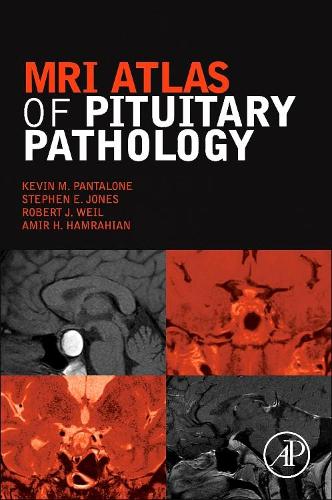 Паперова книга «MRI Atlas of Pituitary Pathology», авторів Амір Х. Хамрагіан, Кевін М. Панталоне, Роберт Й. Вайль, Стівен Е. Джонс - фото №1