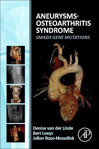Бумажная книга «Aneurysms-Osteoarthritis Syndrome: SMAD3 Gene Mutations», авторов Барт Л. Лойс, Дениз ван дер Линде, Джолиен Роос-Хесселинк - фото №1