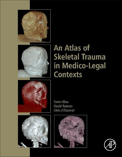 Бумажная книга «An Atlas of Skeletal Trauma in Medico-Legal Contexts», авторов Крис О'Доннелл, Дэвид Л. Рэнсон, Сорен Блау - фото №1
