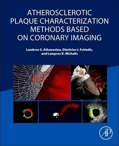 Бумажная книга «Atherosclerotic Plaque Characterization Methods Based on Coronary Imaging», авторов Димитриос И Фотиадис, Ламброс С Атанасиу, Лампрос К Михалис - фото №1