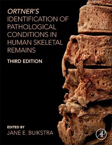 Паперова книга «Ortner's Identification of Pathological Conditions in Human Skeletal Remains» - фото №1
