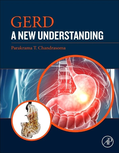 Паперова книга «GERD: A New Understanding of Pathology, Pathophysiology, and Treatment», автор Паракрама Т. Чандрасома - фото №1