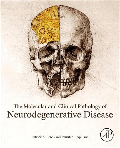 Паперова книга «The Molecular and Clinical Pathology of Neurodegenerative Disease», авторів Дженніфер Е. Спіллейн, Патрік А. Льюїс - фото №1