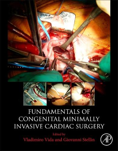 Паперова книга «Fundamentals of Congenital Minimally Invasive Cardiac Surgery», авторів Джованні Стеллін, Владіміро Віда - фото №1