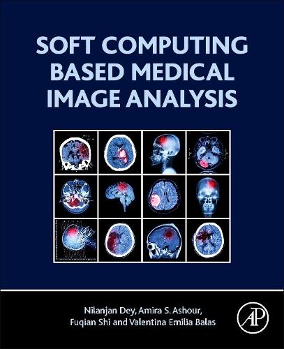 Паперова книга «Soft Computing Based Medical Image Analysis», авторів Аміра С. Ашур, Фукуянь Ши, Ніланджан Дей, Валентина Емілія Балас - фото №1