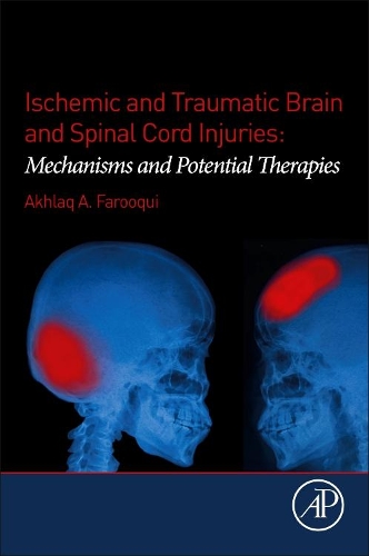 Паперова книга «Ischemic and Traumatic Brain and Spinal Cord Injuries: Mechanisms and Potential Therapies», автор Ахлак А. Фарукі - фото №1