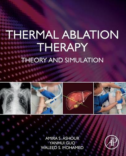 Паперова книга «Thermal Ablation Therapy: Theory and Simulation», авторів Аміра С. Ашур, Валід С. Мохамед, Яньхуй Го - фото №1