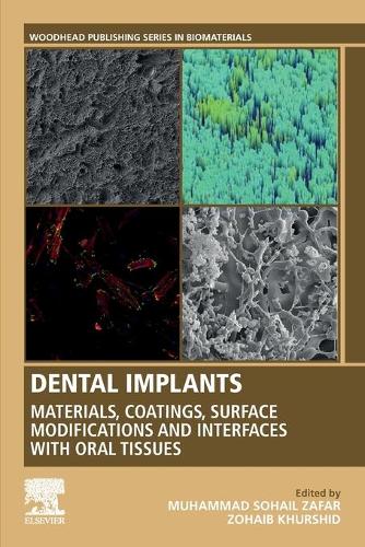 Паперова книга «Dental Implants: Materials, Coatings, Surface Modifications and Interfaces with Oral Tissues», авторів Мухаммад Зафар, Зохаїб Хуршид - фото №1