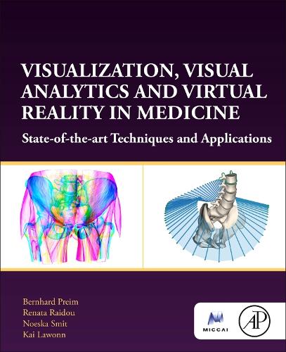 [object Object] «Visualization, Visual Analytics and Virtual Reality in Medicine: State-of-the-art Techniques and Applications», авторів Бернхард Прейм, Кай Лауонн, Ноеска Сміт, Рената Райду - фото №1