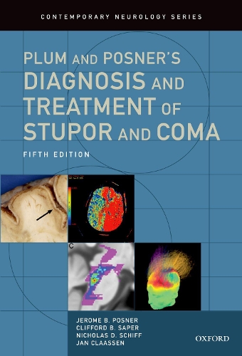 Бумажная книга «Plum and Posner's Diagnosis and Treatment of Stupor and Coma», авторов Клиффорд Б. Сапер, Ян Клаассен, Джером Б. Познер, Николас Д. Шифф - фото №1