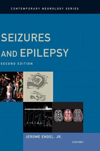 Паперова книга «Seizures and Epilepsy», автор Джером Енгель-молодший - фото №1