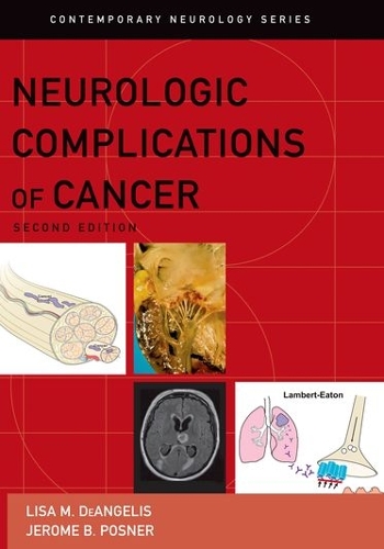 Бумажная книга «Neurologic Complications of Cancer», автор Лиза М. ДеАнджелис - фото №1