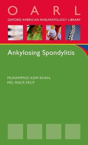 Паперова книга «Ankylosing Spondylitis», автор Мухаммад Асім Хан - фото №1