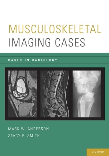 Бумажная книга «Musculoskeletal Imaging Cases», авторов Марк В. Андерсон, Стейси Э. Смит - фото №1