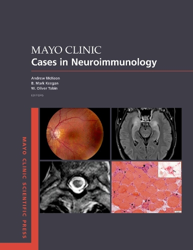 Бумажная книга «Mayo Clinic Cases in Neuroimmunology», автор Б. Марк Киган - фото №1