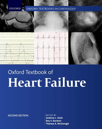 Бумажная книга «Oxford Textbook of Heart Failure» - фото №1