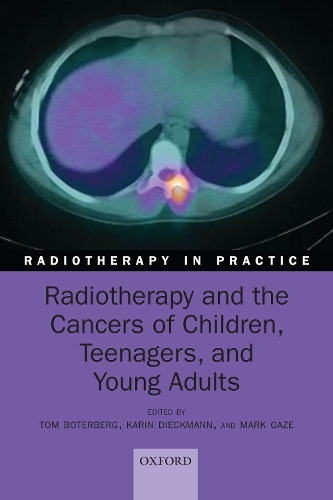 Paper book «Radiotherapy and the Cancers of Children, Teenagers, and Young Adults» - фото №1