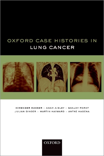 Паперова книга «Oxford Case Histories in Lung Cancer», авторів Адам Ейнлі, Антке Гаґена, Хімендер К. Маккер, Джуліан Сінґер, Мартін Гейворд, Санджай Попат - фото №1