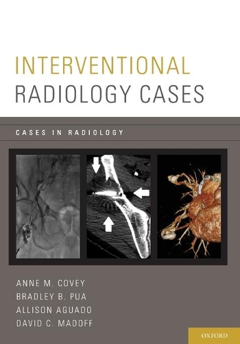 Паперова книга «Interventional Radiology Cases», авторів Еллісон Агуадо, Енн М. Кові, Бредлі П. Пуа, Девід К. Медофф - фото №1
