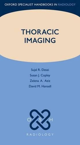 Бумажная книга «Thoracic Imaging», авторов Дэвид М. Хэнселл, Суджал Р. Десаи, Сьюзан Дж. Копли, Зелена А. Азиз - фото №1