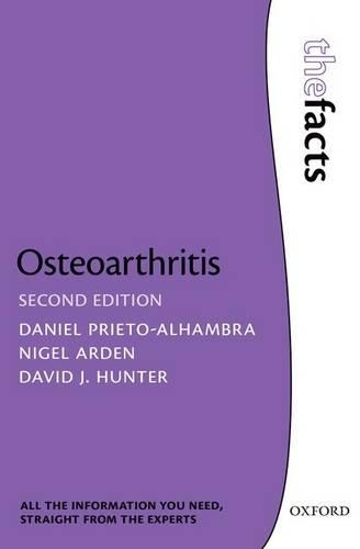 Бумажная книга «Osteoarthritis: The Facts», авторов Дэвид Дж. Хантер, Найджел Арден - фото №1