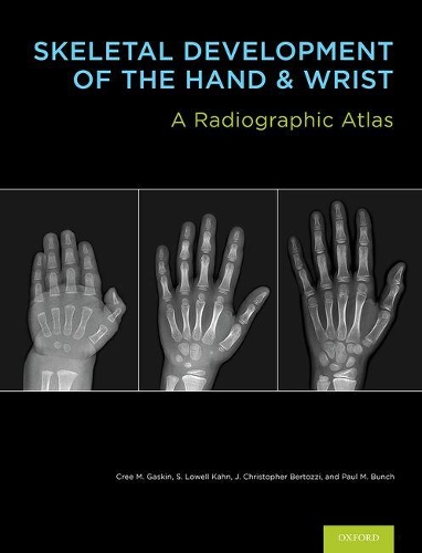 Бумажная книга «Skeletal Development of the Hand and Wrist: A Radiographic Atlas and Digital Bone Age Companion», авторов Кри М. Гаскин, С. Лоуэлл Кан - фото №1