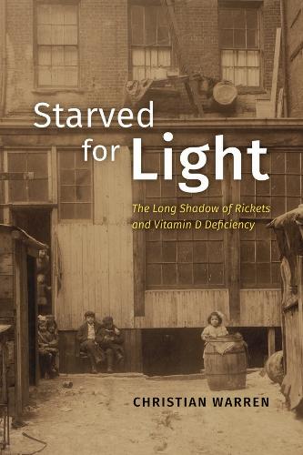 Паперова книга «Starved for Light: The Long Shadow of Rickets and Vitamin D Deficiency», автор Крістіан Воррен - фото №1