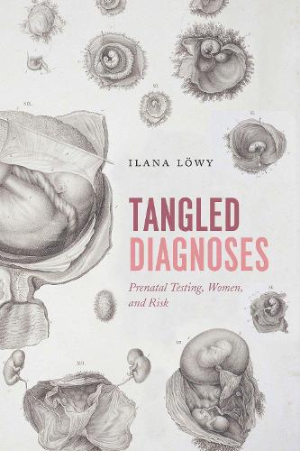 Паперова книга «Tangled Diagnoses: Prenatal Testing, Women, and Risk», автор Ілана Льові - фото №1