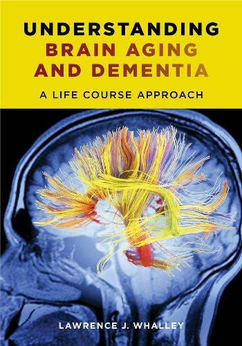 Паперова книга «Understanding Brain Aging and Dementia: A Life Course Approach», автор Лоуренс Дж. Уоллі - фото №1