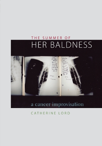 Бумажная книга «The Summer of Her Baldness: A Cancer Improvisation», автор Кэтрин Лорд - фото №1