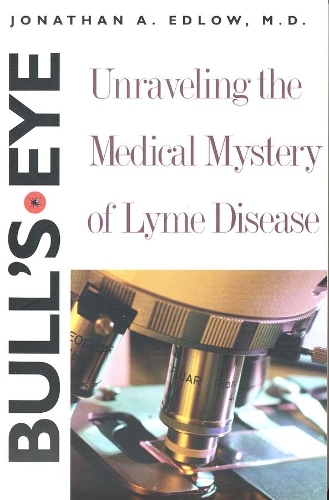 Бумажная книга «Bull’s-Eye: Unraveling the Medical Mystery of Lyme Disease, Second Edition», автор Джонатан А. Эдлоу - фото №1