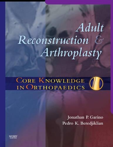 Бумажная книга «Core Knowledge in Orthopaedics: Adult Reconstruction and Arthroplasty», авторов Джонатан Гарино, Педро К. Береджиклян - фото №1