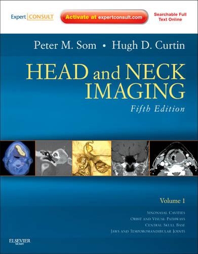 Бумажная книга «Head and Neck Imaging - 2 Volume Set: Expert Consult- Online and Print», авторов Хью Д. Куртин, Питер М. Сом - фото №1