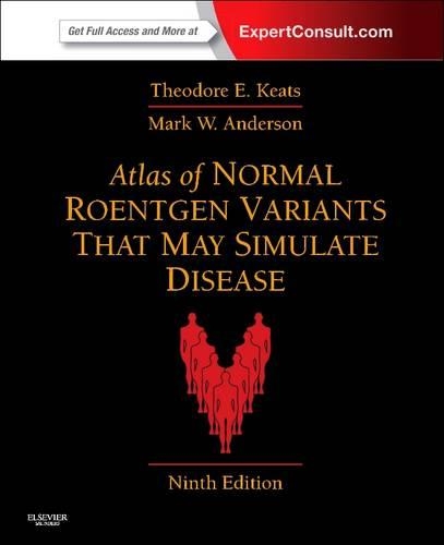 Бумажная книга «Atlas of Normal Roentgen Variants That May Simulate Disease: Expert Consult - Enhanced Online Features and Print», авторов Марк В. Андерсон, Теодор Э. Китс - фото №1