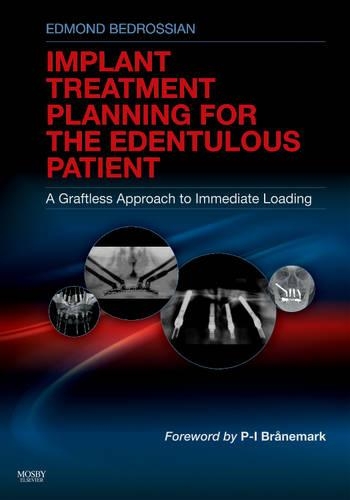 Бумажная книга «Implant Treatment Planning for the Edentulous Patient: A Graftless Approach to Immediate Loading», автор Эдмон Бедросян - фото №1