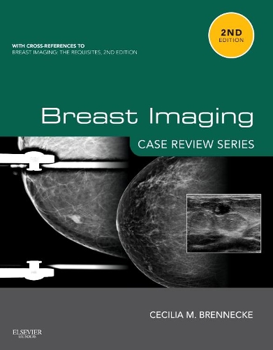 Бумажная книга «Breast Imaging: Case Review Series», автор Сесилия М. Бреннеке - фото №1