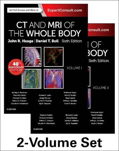 Бумажная книга «CT and MRI of the Whole Body, 2-Volume Set», авторов Даниэль Болл, Джон Р. Хаага - фото №1