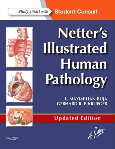 Паперова книга «Netter's Illustrated Human Pathology Updated Edition: with Student Consult Access», авторів Герхард Р. Ф. Крюгер, Л. Максиміліан Бужа - фото №1