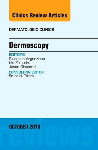 Бумажная книга «Dermoscopy, an Issue of Dermatologic Clinics», авторов Джузеппе Аргенциано, Айрис Залаудек, Джейсон Джакомел - фото №1