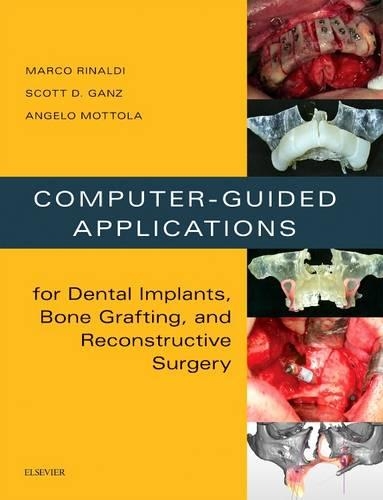 Паперова книга «Computer-Guided Applications for Dental Implants, Bone Grafting, and Reconstructive Surgery (adapted translation)», авторів Анджело Моттола, Марко Рінальді, Скотт Д. Ганц - фото №1
