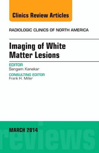 Бумажная книга «Imaging of White Matter, An Issue of Radiologic Clinics of North America», автор Сангам Канекар - фото №1