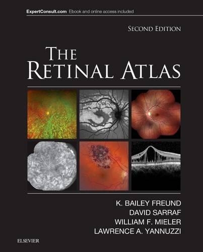 Бумажная книга «The Retinal Atlas», авторов Дэвид Сарраф, K. Бейли Френд, Лоуренс А. Яннуцци, Уильям Ф. Милер - фото №1