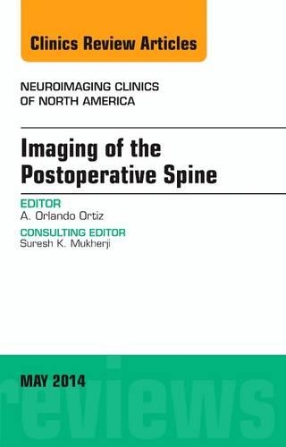 [object Object] «Imaging of the Postoperative Spine, An Issue of Neuroimaging Clinics», автор Орландо Ортіс - фото №1