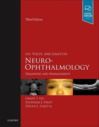 Бумажная книга «Liu, Volpe, and Galetta's Neuro-Ophthalmology: Diagnosis and Management», авторов Грант Т. Лю, Николас Дж. Вольпе, Стивен Л. Галетта - фото №1