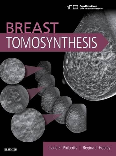 Бумажная книга «Breast Tomosynthesis», авторов Лиана Э. Филпоттс, Регина Джей Хули - фото №1