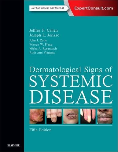 Бумажная книга «Dermatological Signs of Systemic Disease», авторов Джеффри П. Каллен, Джон Дж. Зон, Джозеф Л. Джориццо, Миша А. Розенбах, Рут Энн Влюгельс, Уоррен Пиетт - фото №1