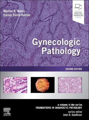 [object Object] «Gynecologic Pathology: A Volume in Foundations in Diagnostic Pathology Series», автор Мариса Р. Нуччи - фото №1
