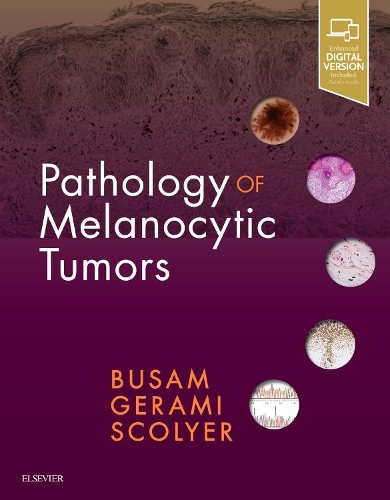 Паперова книга «Pathology of Melanocytic Tumors», авторів Клаус Й. Бусам, Педрам Герамі, Річард А. Сколієр - фото №1
