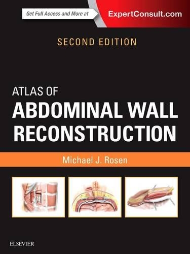 Бумажная книга «Atlas of Abdominal Wall Reconstruction», автор Майкл Дж. Розен - фото №1